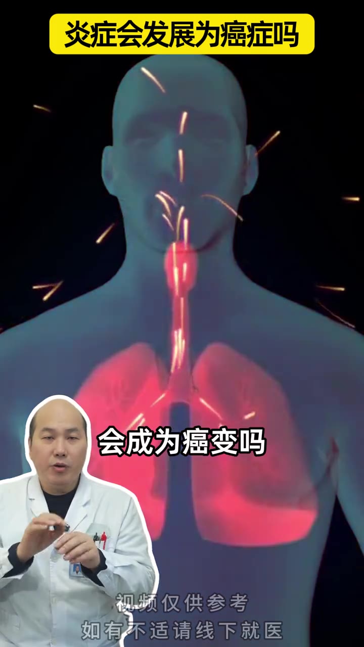炎症发展为癌症需多长时间
